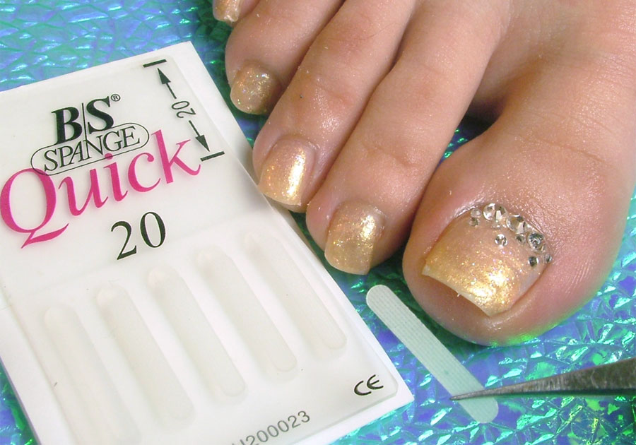 巻き爪矯正(B/Sブレイスクイック)｜ネイルサロン＆スクール キャリノ