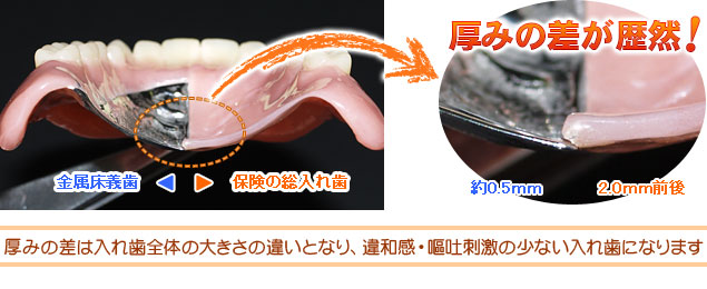 自費の義歯・入れ歯 / 大田区 大森駅前 歯医者さん「内田歯科医院